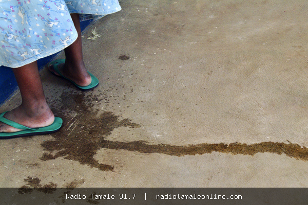 Obstetric fistula: A preventable childbirth injury leaving women suffering in silence