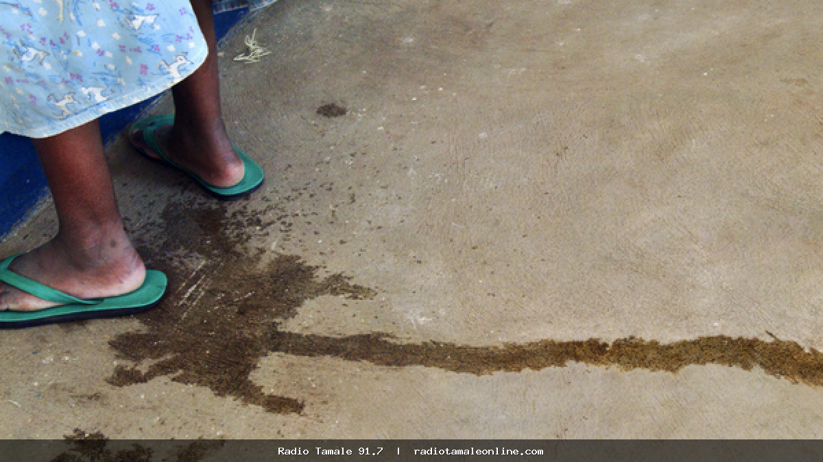 Obstetric fistula: A preventable childbirth injury leaving women suffering in silence